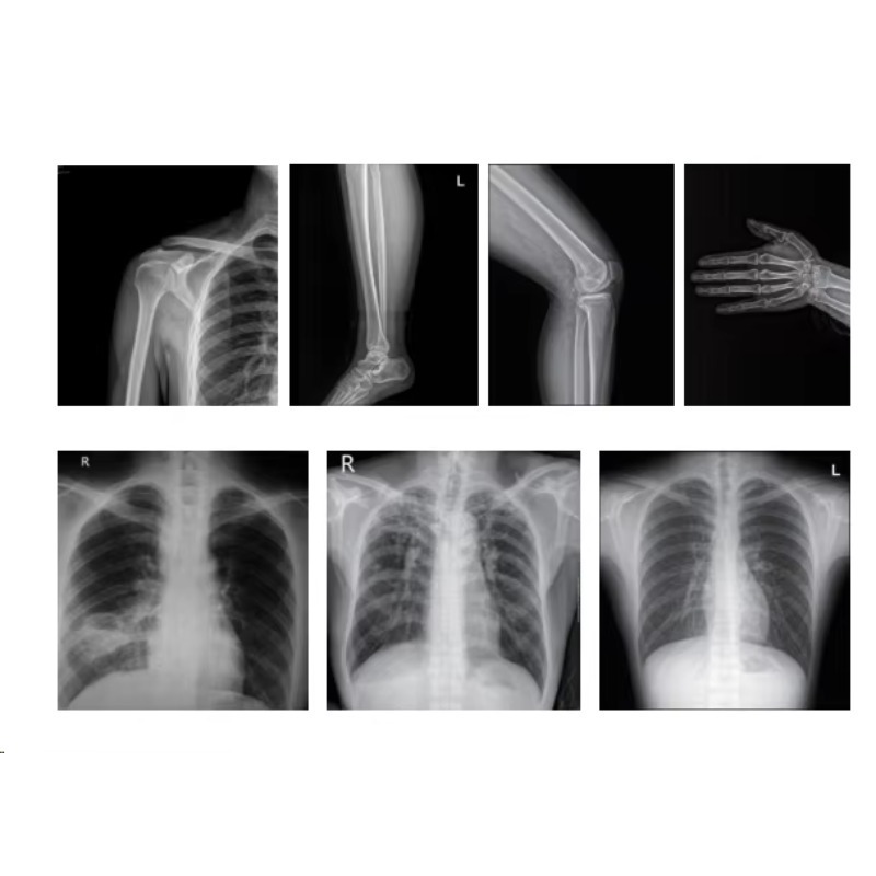 Medical Imaging X-ray Machine  - Photography X Ray recension och pris